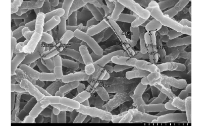 Como o Bacillus Aryabhattai Combate o Estresse da Soja